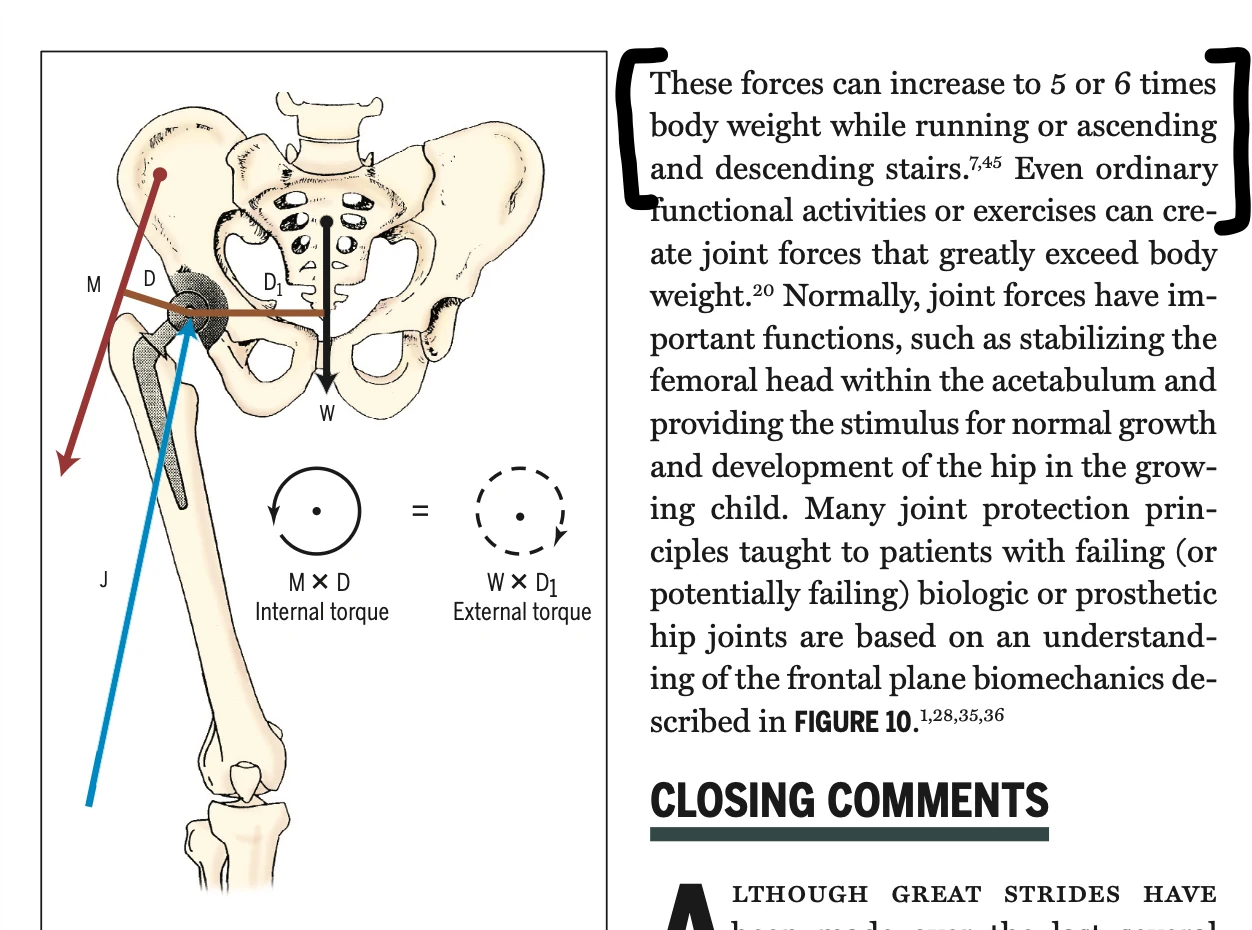 Biomechanics diagram showing the gluteus medius countering the external force that tips the pelvis during single-leg support