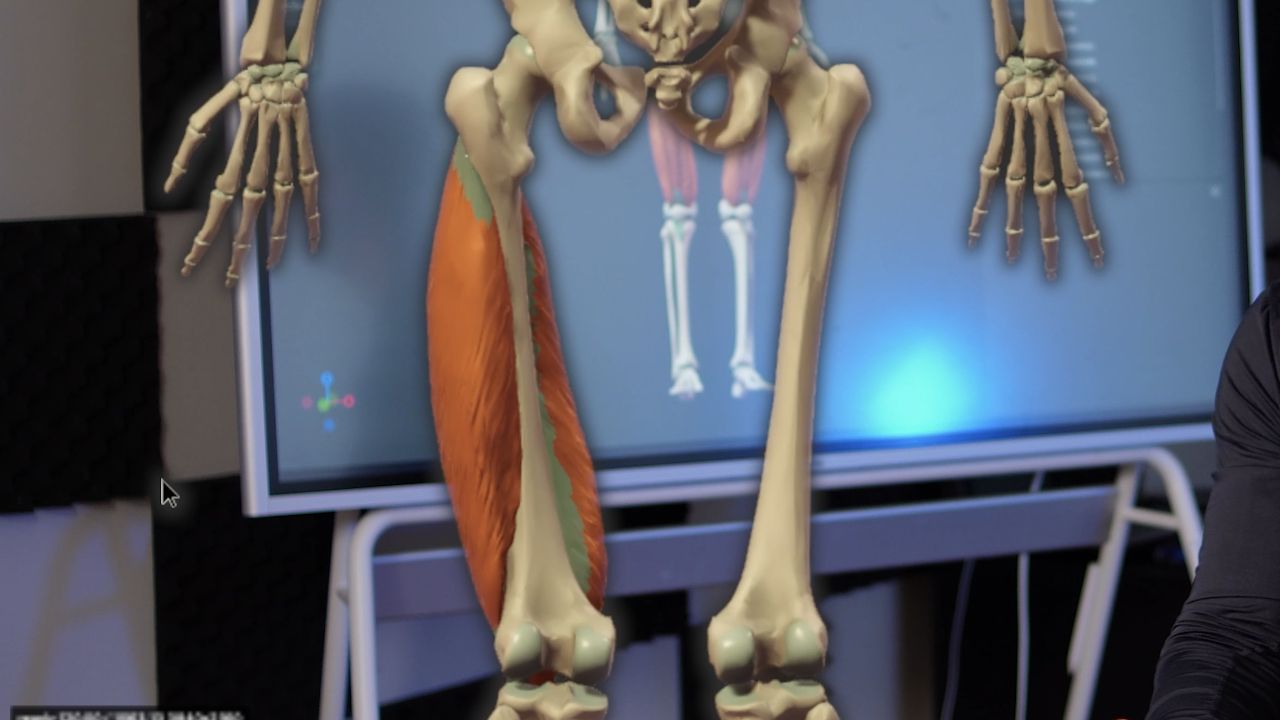 Anterior thigh anatomy with the quadriceps heads visible around the femur